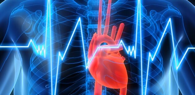 Torasik osteokondroz, kalp bölgesinde ağrı hissine eşlik edebilir. 