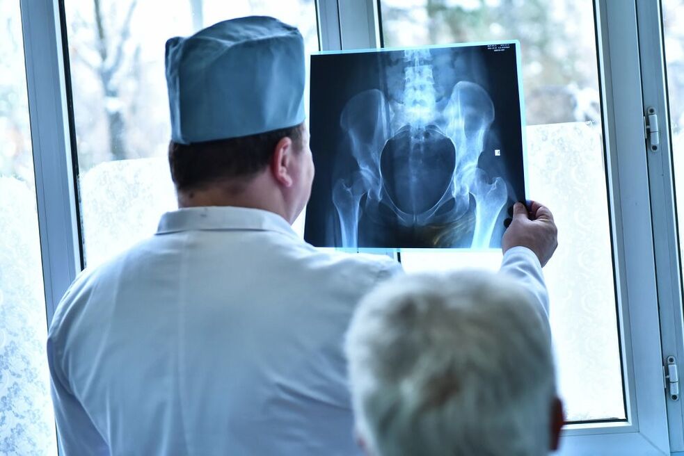 Doktor artrozlu kalça ekleminin resmine bakar